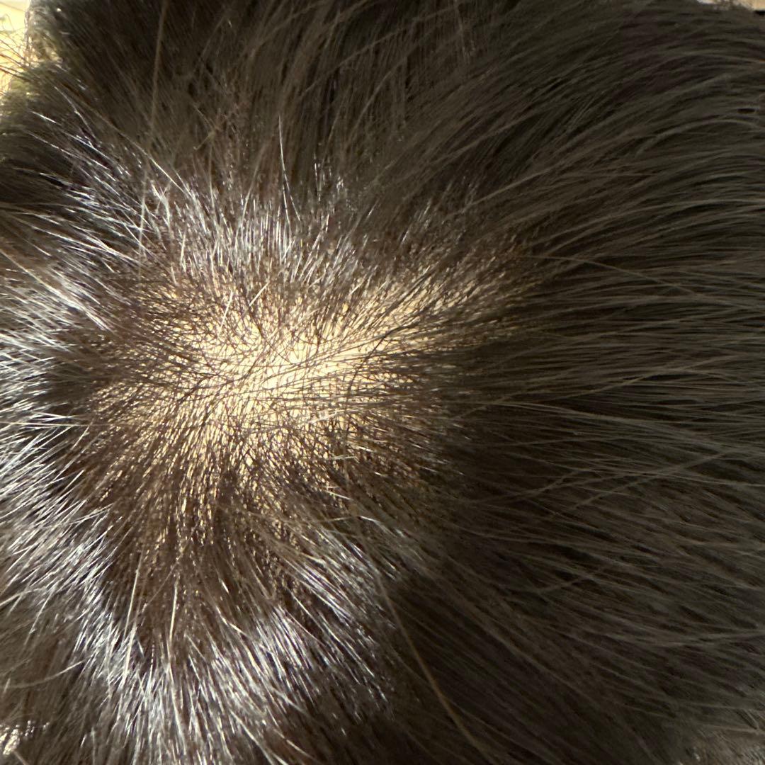 医療用ウィッグ　アートネイチャー　ジュリアオージェ　ショート