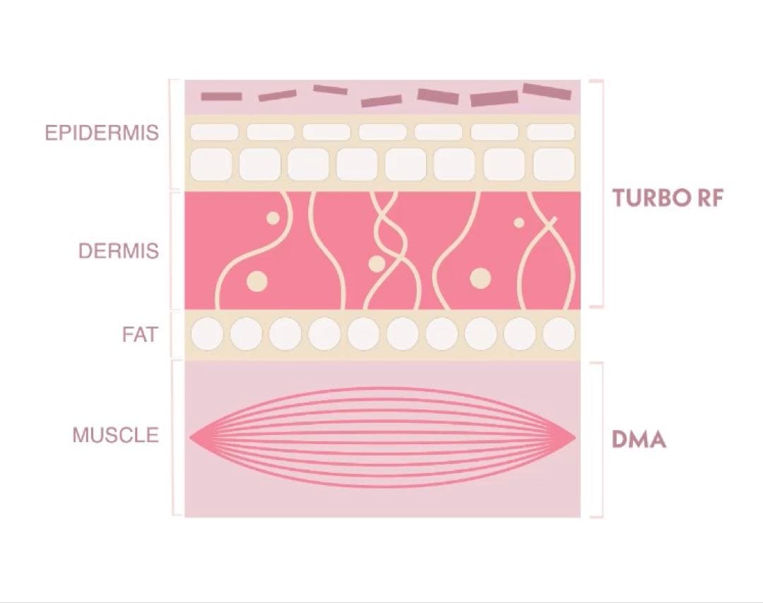 【美品】TRIPOLAR トライポーラ vx2 ラジオ波 SMASアップEMS