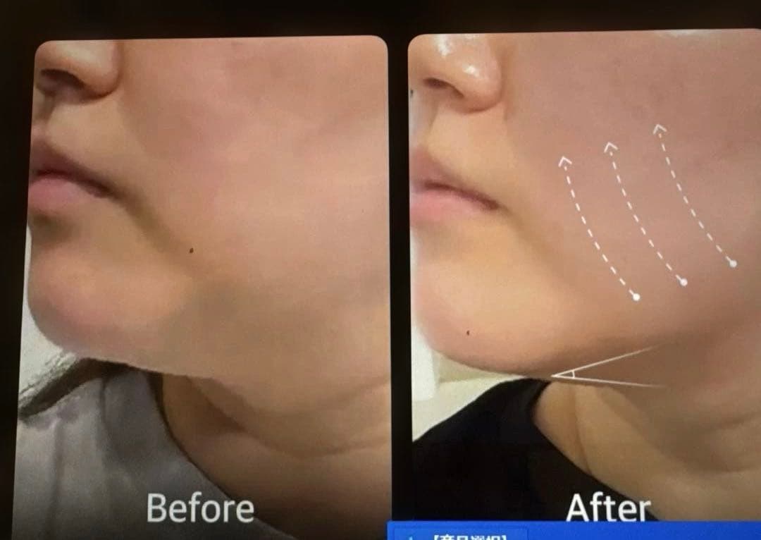 【送料込】medicube 美容デバイス & ブースタージェル