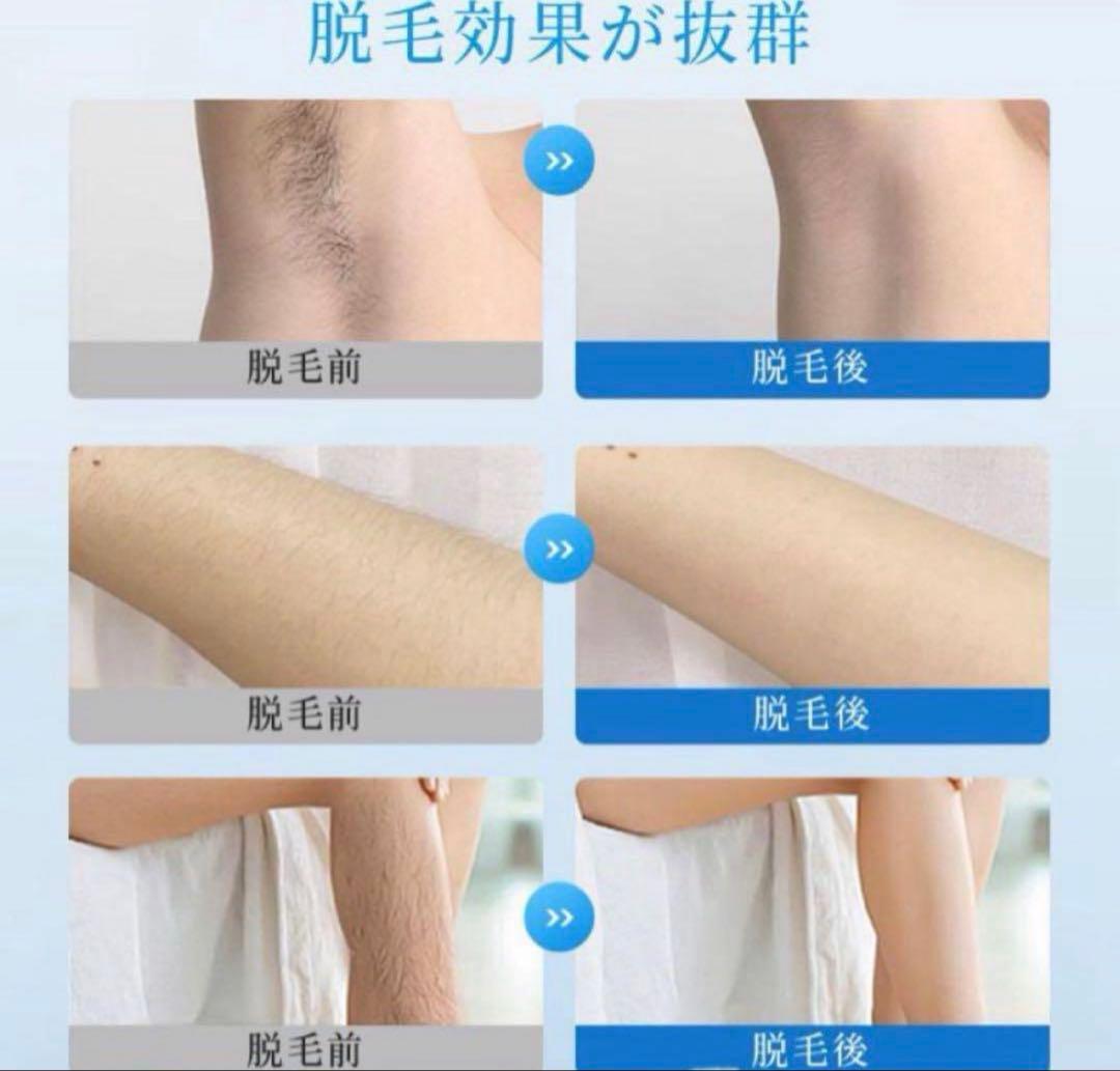 脱毛器　エステ　美容　除毛　ムダ毛ケア　人気　脱毛　男女兼用　ボディケア