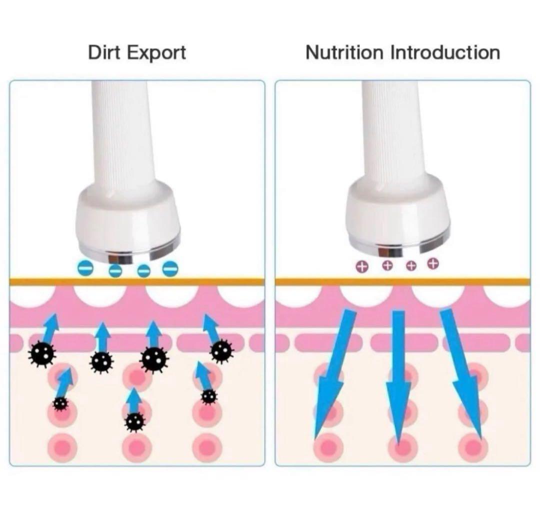 業務用 シミ取り スーパーソニック 美顔器 エステ用 ホクロ