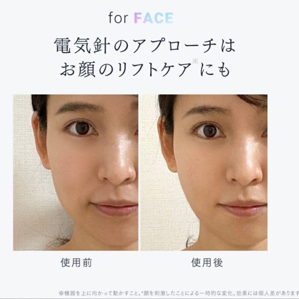 【美品】MYTREX 電気針ヘッドスパプロ マイトレックスデンキバリEMS