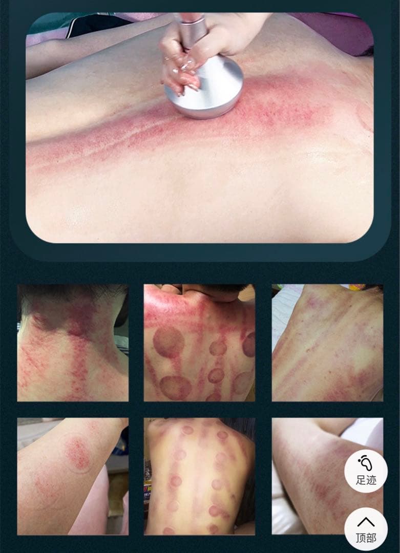 6in1 2023年最新脂肪溶解リポレーザー &80kキャビテーション RF