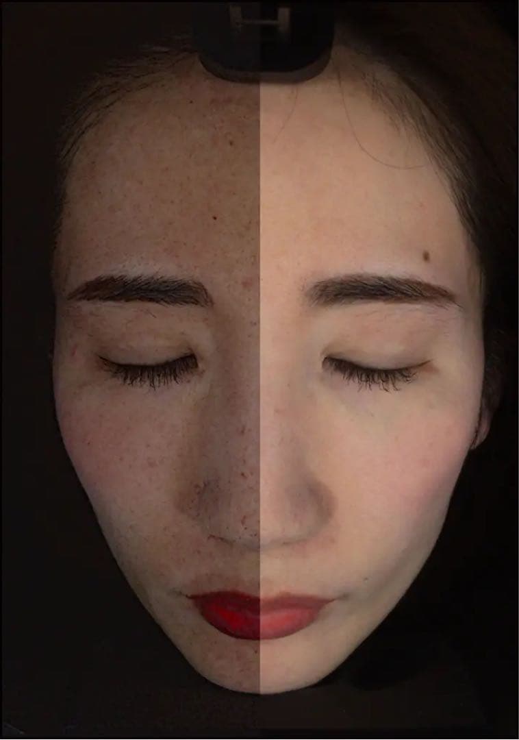 『AxFace』アクサフェイス 最新肌診断器 ビューティーワールド人気！