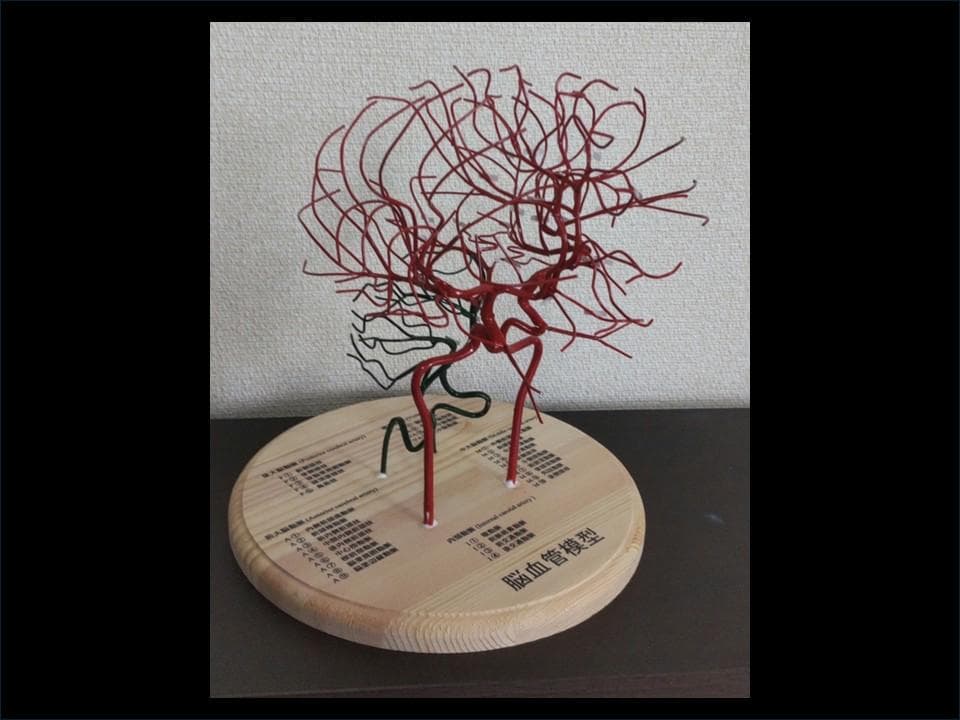 脳血管（内頚動脈、椎骨動脈）模型