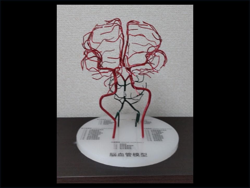 脳血管模型（内頚動脈、椎骨動脈）