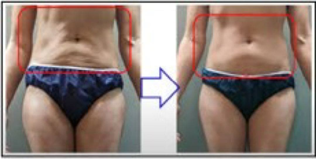 【最強痩身クリーム‼️】NFクリーム McCoy ノンFシリーズ /サロン専売品