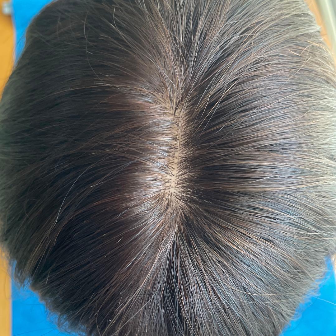 医療用ウィッグ　人毛100% Ｌsize