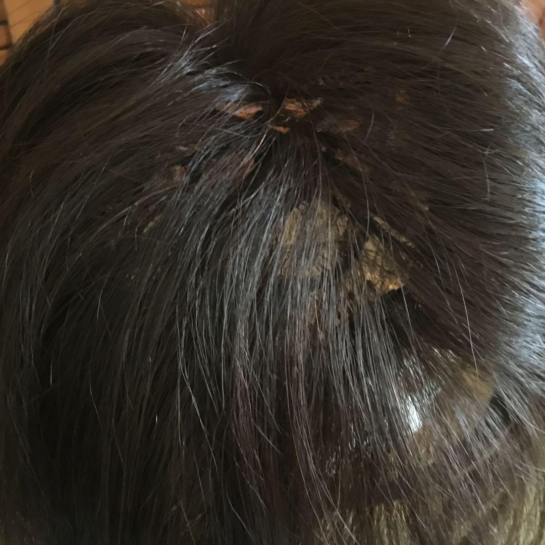 ぼむぼむ。 新品未使用　レオンカ トップピース　SF-T78.