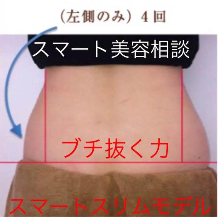 美容機器 キャビテーション 2in1 ラジオ波 リフトアップマシン 業務用