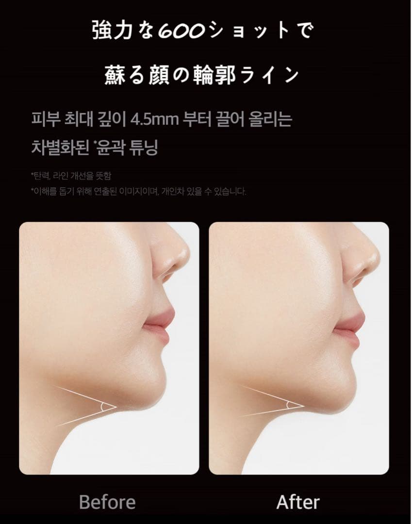 MEDICUBE ハイフォーカスショット