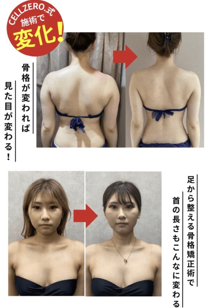 セルゼロスマート　新品サーマチップ、クリーム12L付き