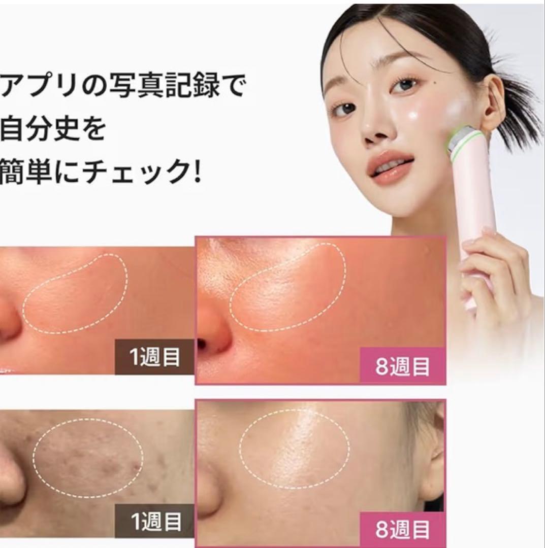 メディキューブ AGE-Rブースタープロ ピンク オールインワン美顔器