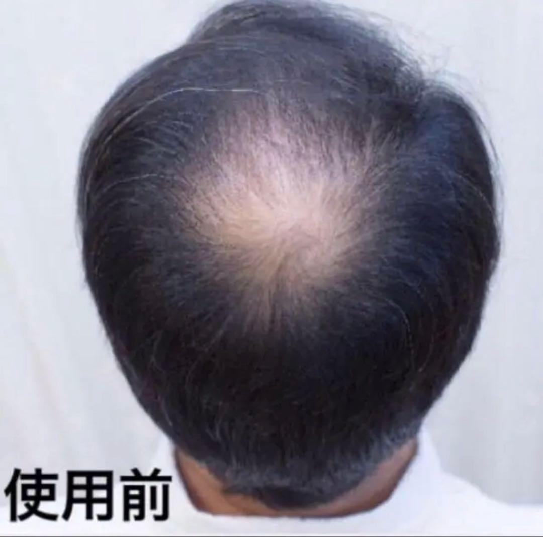 薄毛増毛ふりかけパウダー詰め替え用お得4個セット脱毛症分け目白髪かくしハゲ隠し