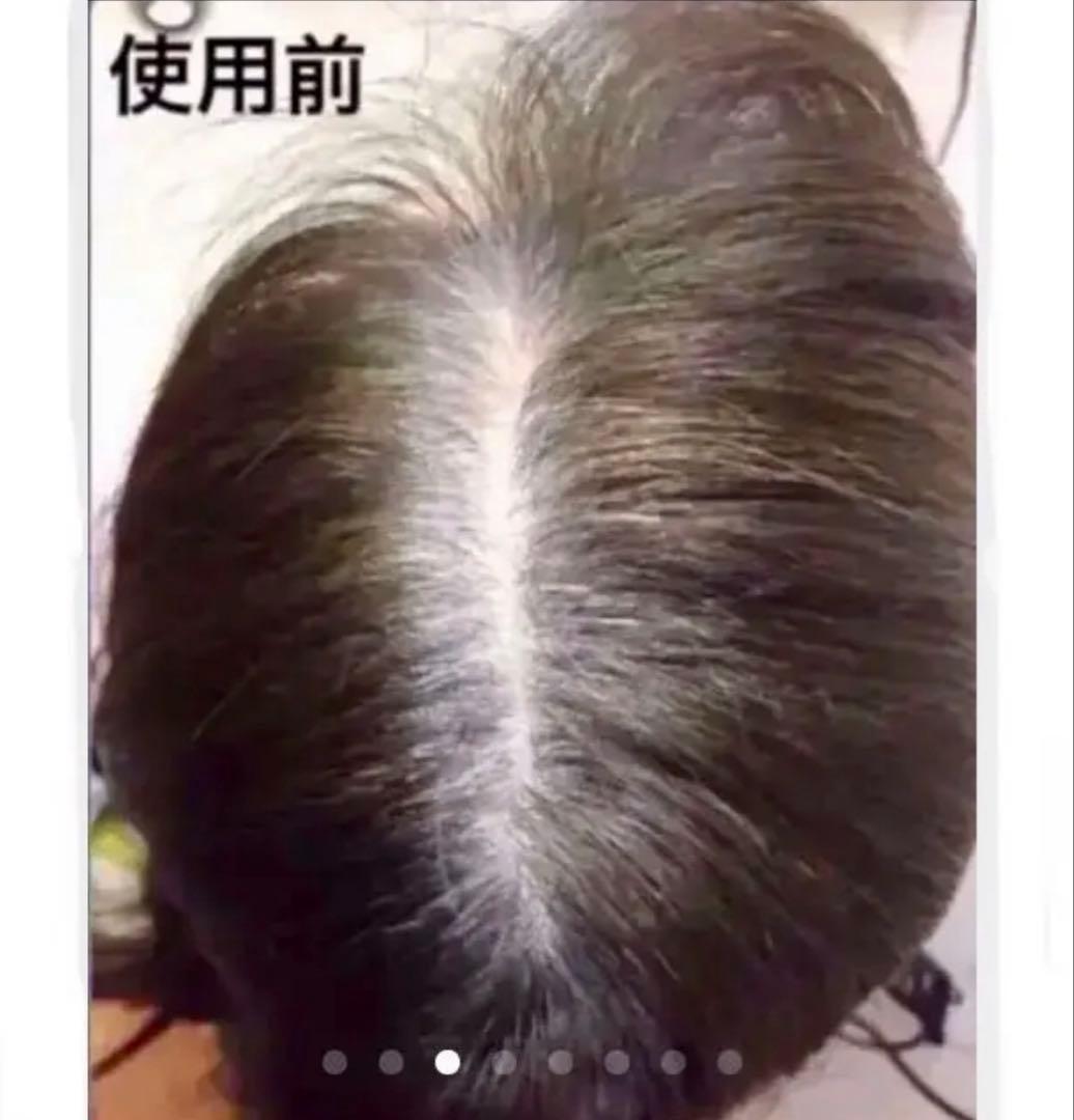 薄毛増毛ふりかけパウダー詰め替え用お得4個セット脱毛症分け目白髪かくしハゲ隠し