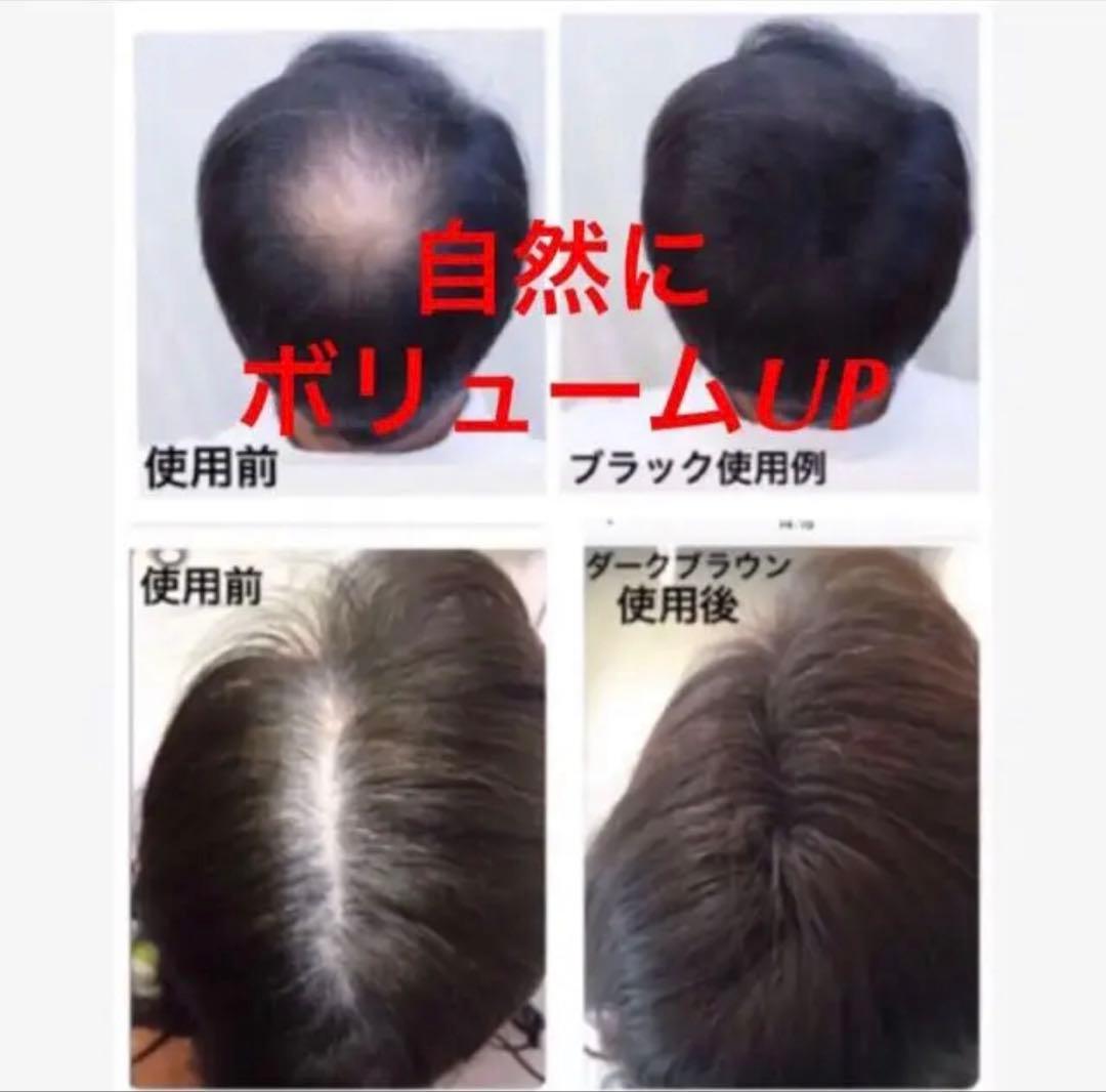 薄毛増毛ふりかけパウダー詰め替え用お得4個セット脱毛症分け目白髪かくしハゲ隠し