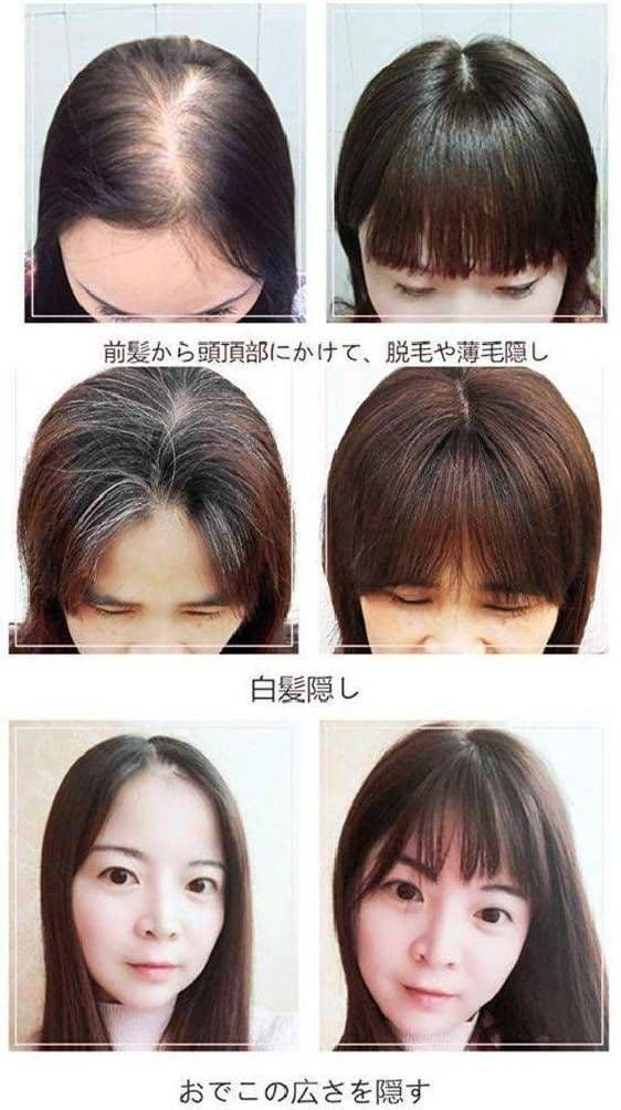 人毛100％前髪付き部分ウィッグ瞬間カバーＩ型つむじ地肌総手植えヘアピース20㎝