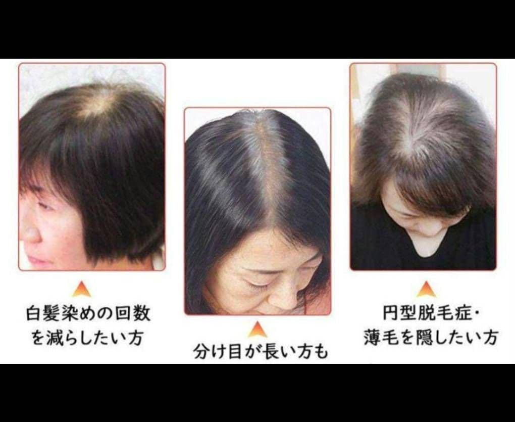 人毛100％前髪付き部分ウィッグ瞬間カバーＩ型つむじ地肌総手植えヘアピース20㎝