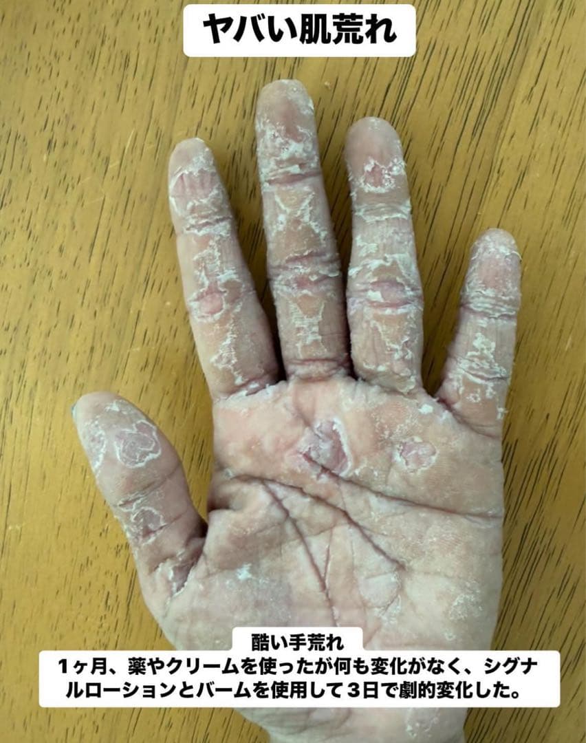 シグナルローション　2本セット