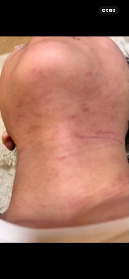 シグナルローション　2本セット