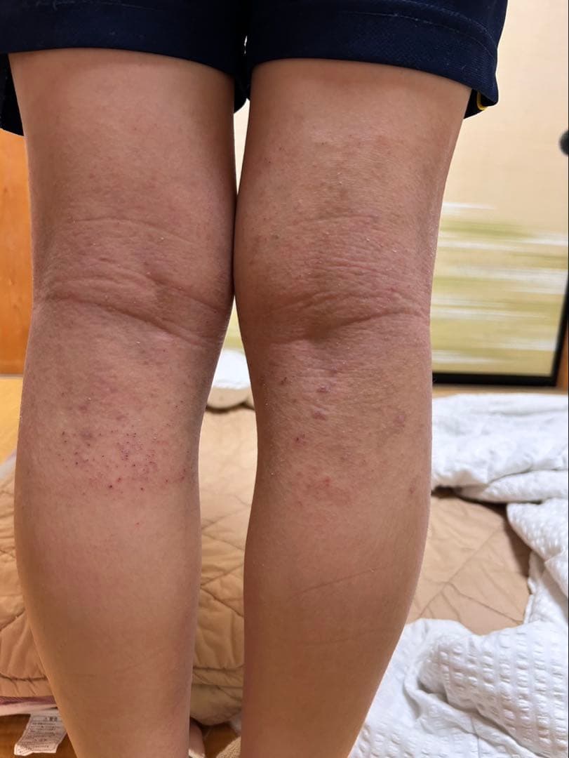 シグナルローション　2本セット