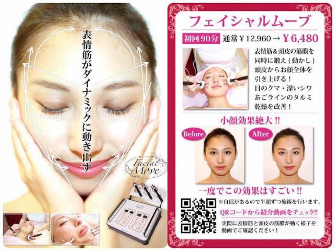 フェイシャルムーヴ　美顔器　エレクトロポレーション　たるみ　しわ　表情筋