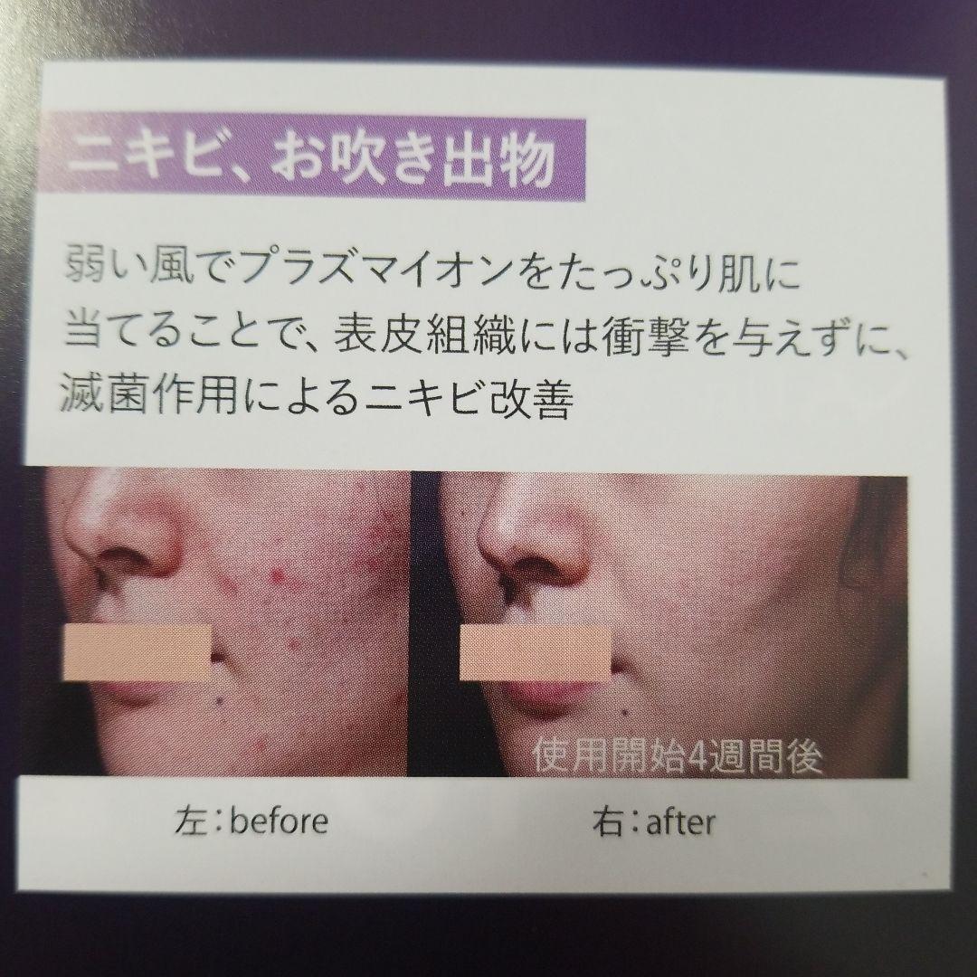 DENSHINDO プラズマエアシャワー美顔器 UN1-W ホワイト