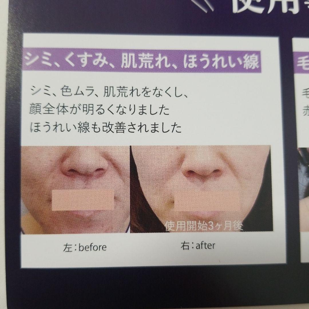 DENSHINDO プラズマエアシャワー美顔器 UN1-W ホワイト