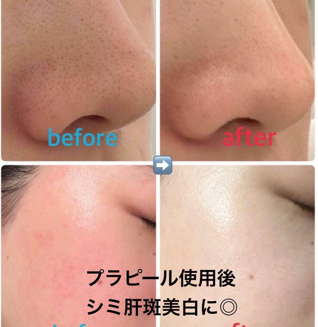 【複数特割☆プラピール】3set×9回分　14,000円