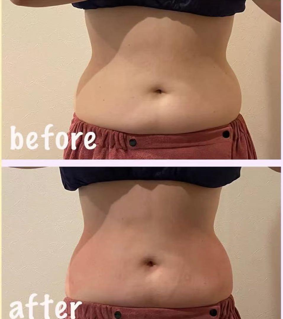 脂肪冷却と電磁パルス４本ハンドル痩身機器