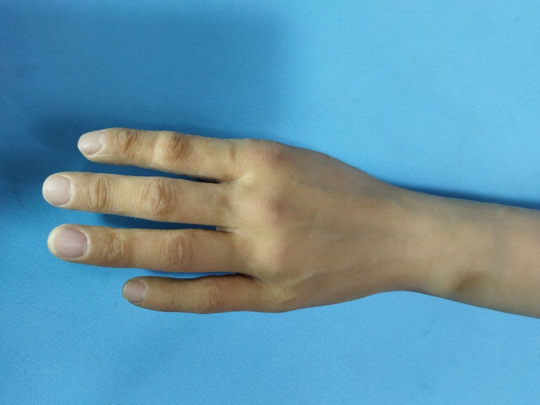 左手　義手　装備　腕　手　コルセット　サポーター　ギブス　コスプレ