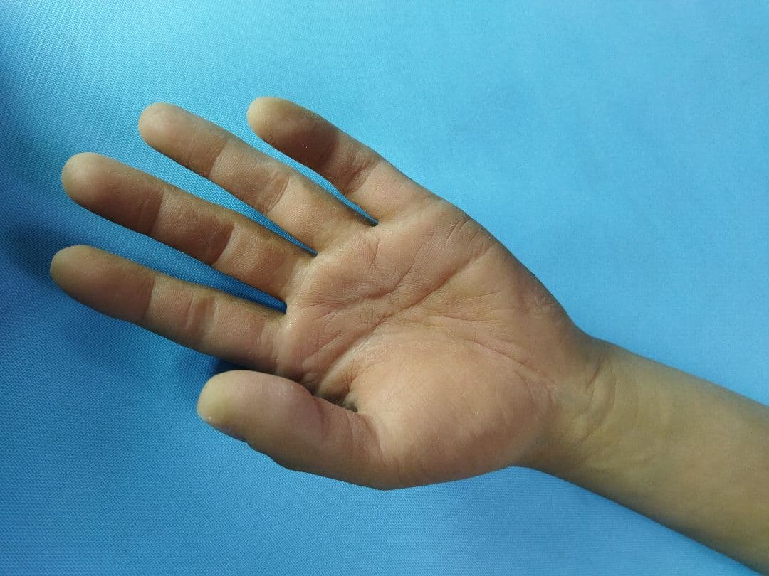 左手　義手　装備　腕　手　コルセット　サポーター　ギブス　コスプレ