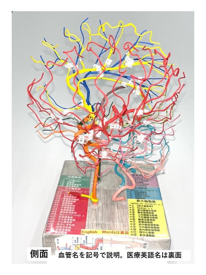 脳血管模型　教育説明用（脳血管模型が必要な人のために）
