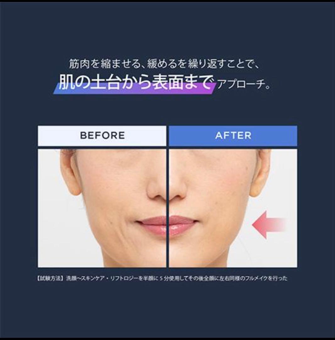 ヤーマン 美顔器 リフトロジーSP 公式 リフトアップ リフトケア