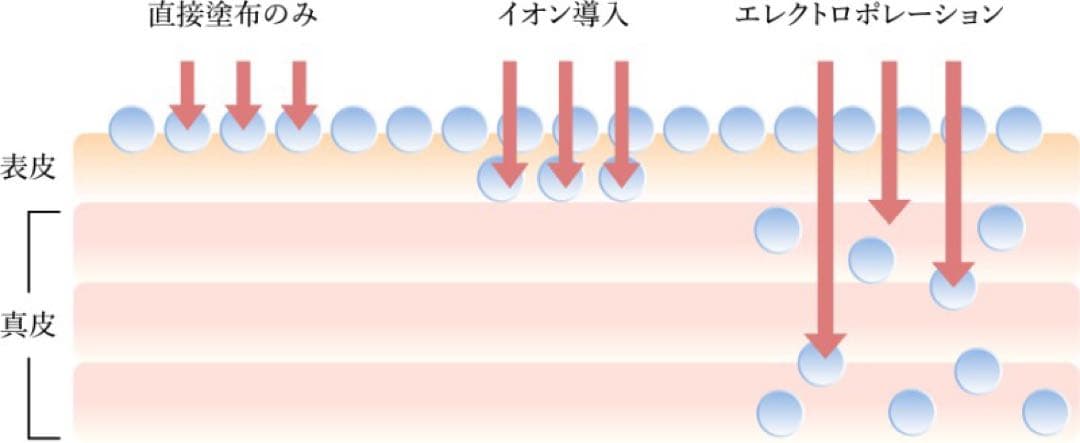 ファシア干渉波美容機器
