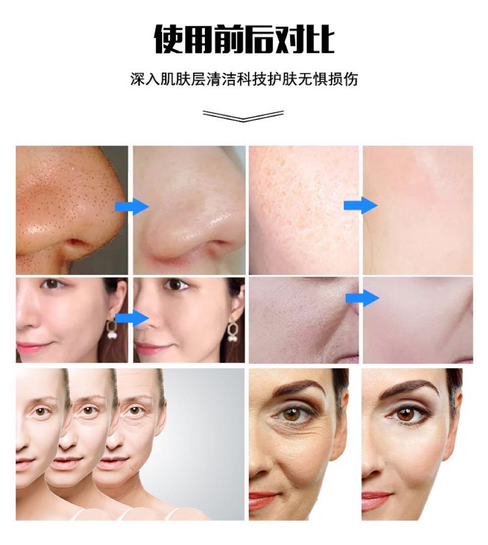 最新版　毛穴洗浄(ハイドラフェイシャル)FARSLIM 美顔器 タッチスクリーン