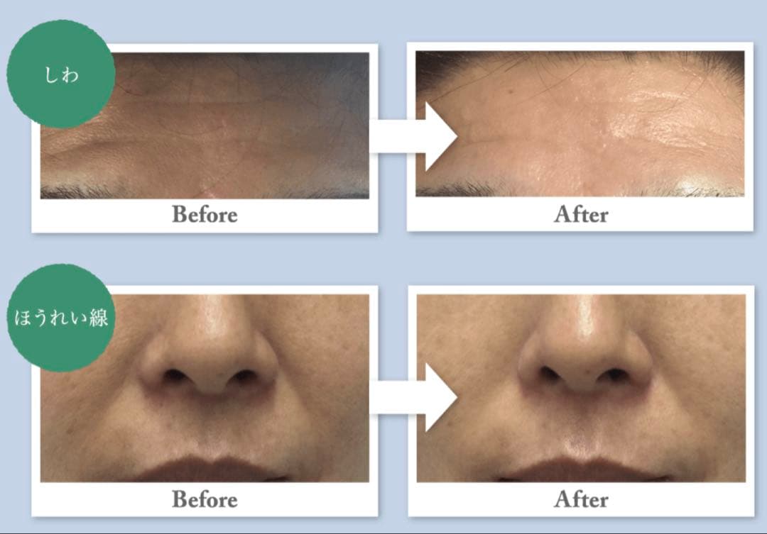 定価74万　アクアエラ　メーカーサポート引継ぎます