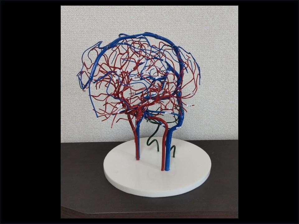 脳血管模型(内頚動脈・椎骨動脈・脳静脈)