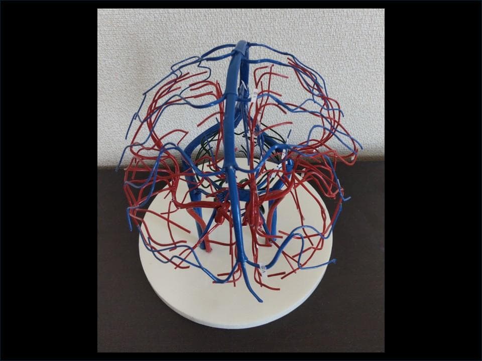 脳血管模型(内頚動脈・椎骨動脈・脳静脈)