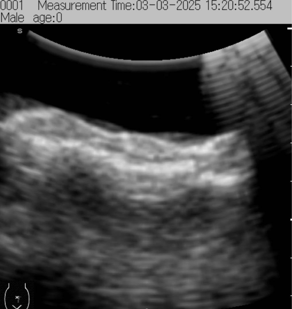 超音波検査装置（エコー）