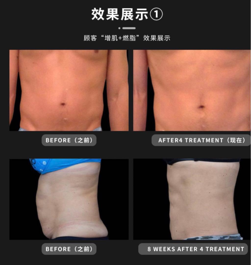 エムズ痩身機器HIMET  新品