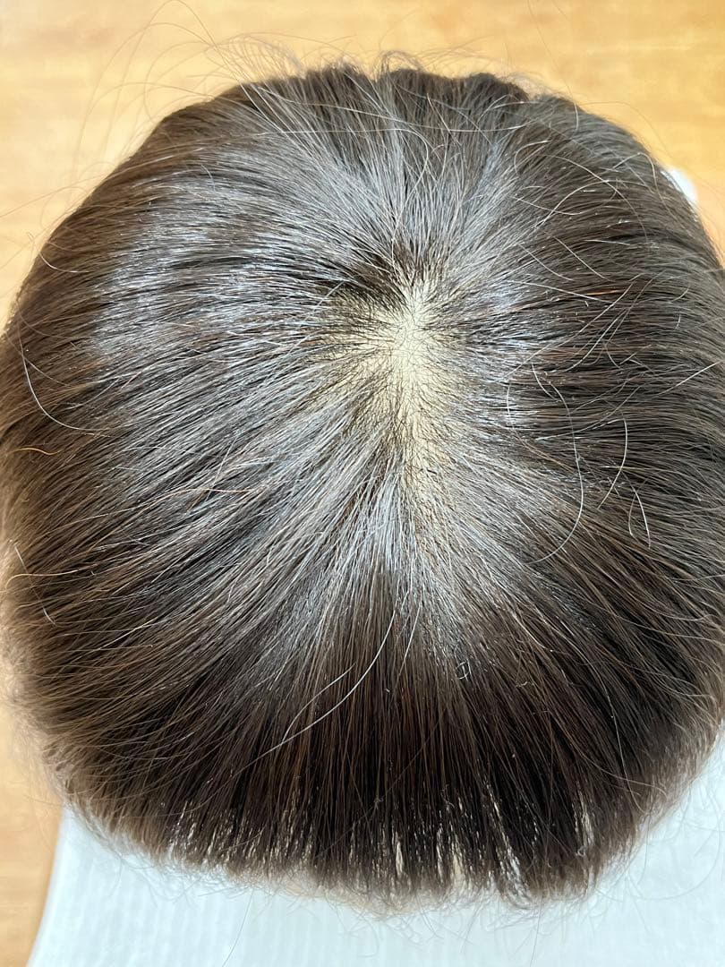 アンベリール　医療用ウィッグ　セット