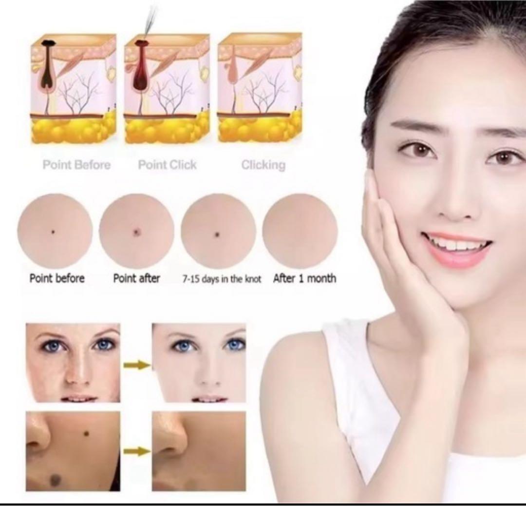 美容機器　スポットケア