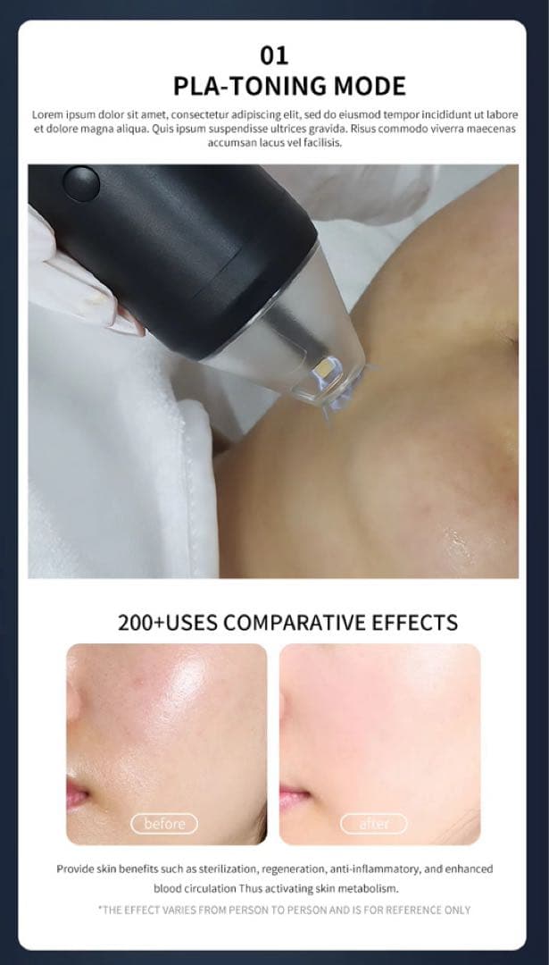 プラズマ・ワンモード ・LDM