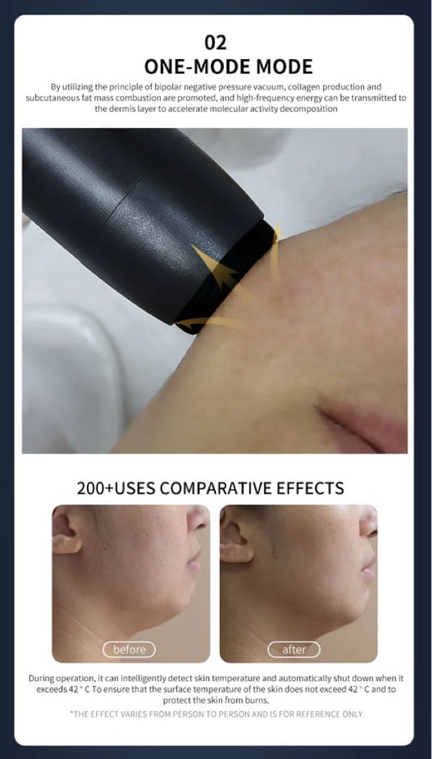 プラズマ・ワンモード ・LDM