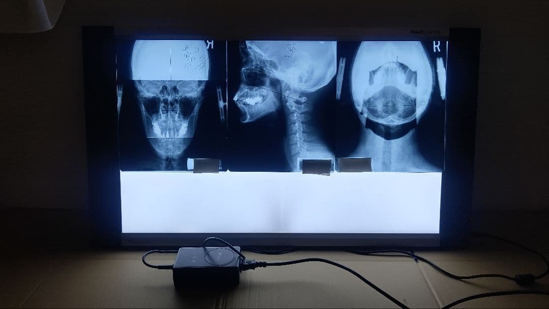 LED大型X線フィルムライトボックス